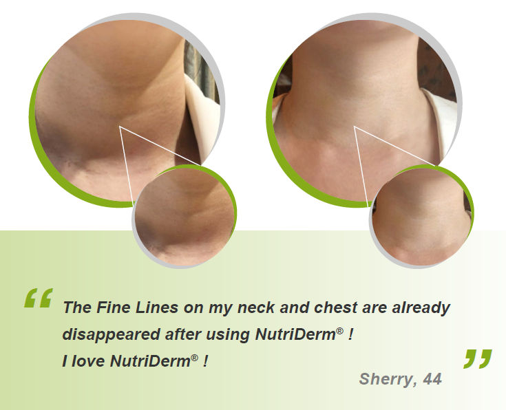nutriderm